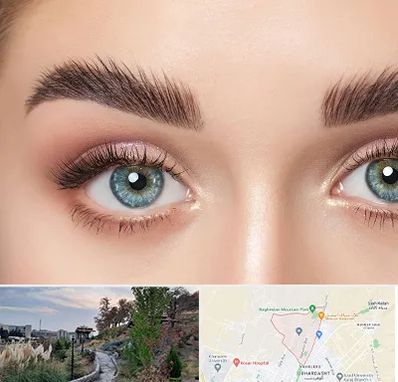 لیفت ابرو در باغستان کرج