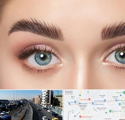 لیفت ابرو در پیروزی 