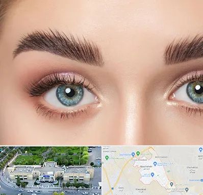 لیفت ابرو در نسیم شهر