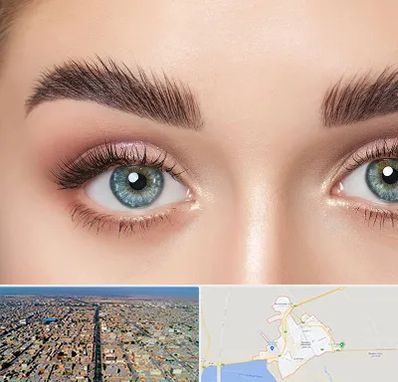 لیفت ابرو در بندر ماهشهر