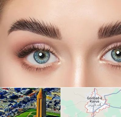 لیفت ابرو در گنبد کاووس