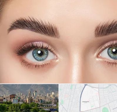 لیفت ابرو در جمشیدیه