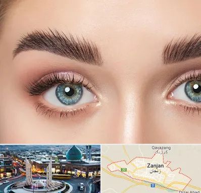 لیفت ابرو در زنجان