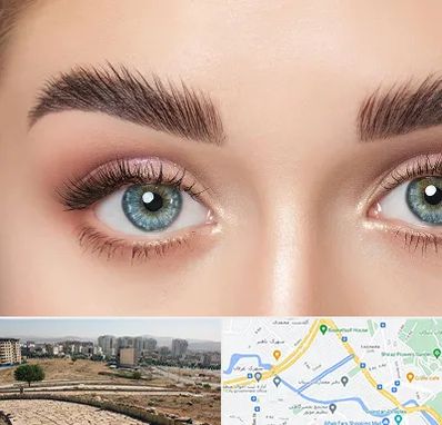 لیفت ابرو در کوی وحدت شیراز