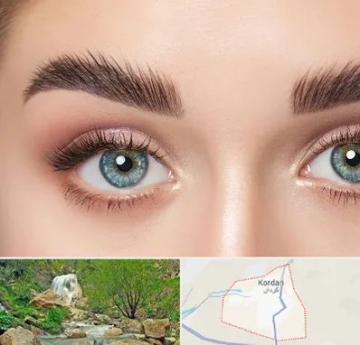 لیفت ابرو در کردان