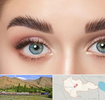 لیفت ابرو در خاش
