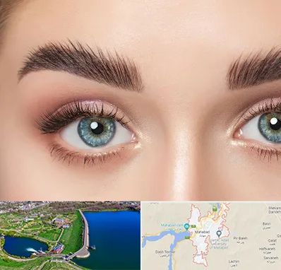 لیفت ابرو در مهاباد