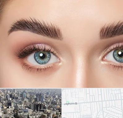 لیفت ابرو در جیحون