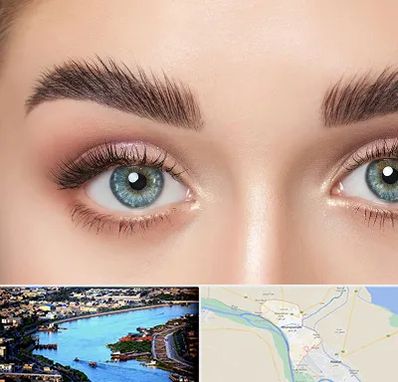 لیفت ابرو در خرمشهر