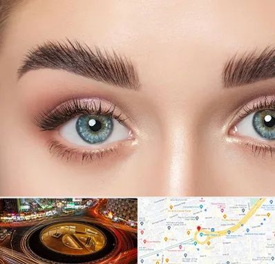 لیفت ابرو در میدان ولیعصر