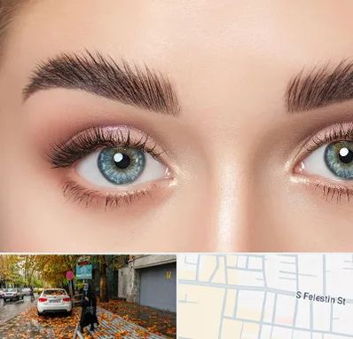 لیفت ابرو در خیابان فلسطین