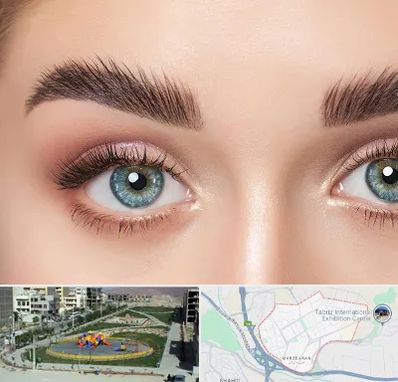 لیفت ابرو در مرزداران تبریز