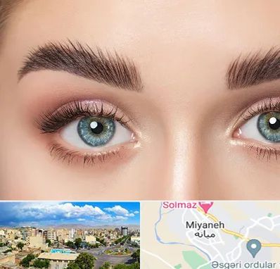 لیفت ابرو در میانه