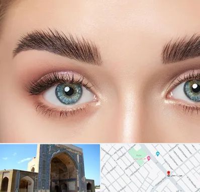 لیفت ابرو در مصلی مشهد