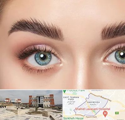 لیفت ابرو در حکیمیه 