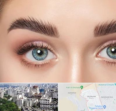 لیفت ابرو در ولنجک 