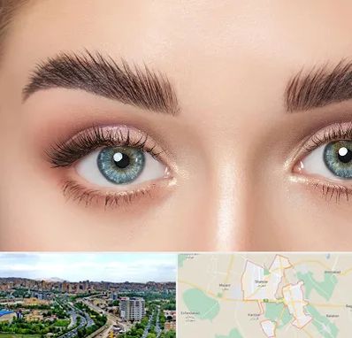 لیفت ابرو در شهریار