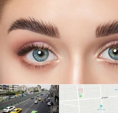 لیفت ابرو در خیابان دامپزشکی
