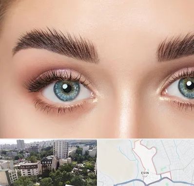 لیفت ابرو در اوین