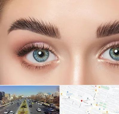 لیفت ابرو در بلوار معلم مشهد