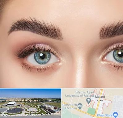 لیفت ابرو در ملارد