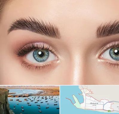 لیفت ابرو در چابهار