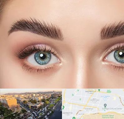 لیفت ابرو در تهرانپارس 