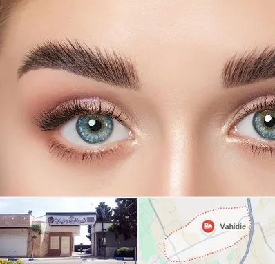 لیفت ابرو در وحیدیه شهریار