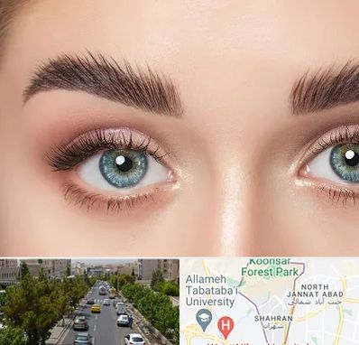 لیفت ابرو در شهران 