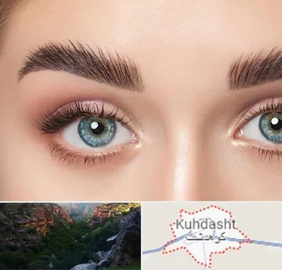 لیفت ابرو در کوهدشت