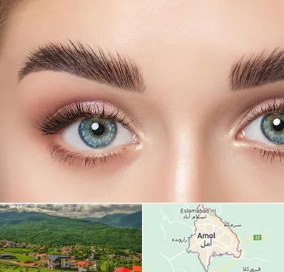 لیفت ابرو در آمل