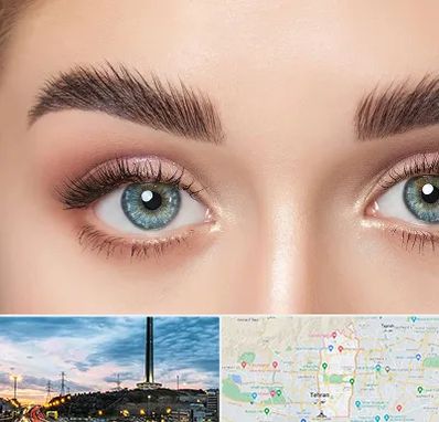 لیفت ابرو در منطقه 2 تهران