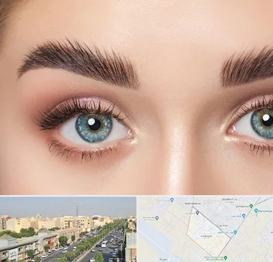 لیفت ابرو در کیانمهر کرج