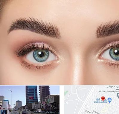 لیفت ابرو در چهارراه طالقانی کرج