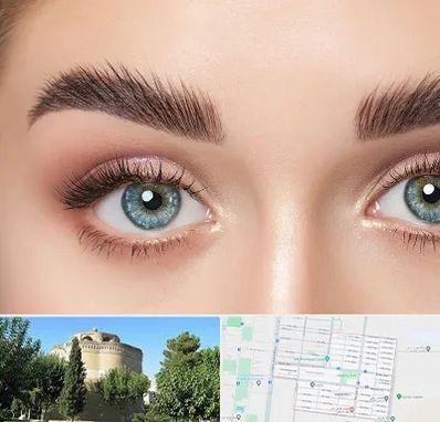 لیفت ابرو در مرداویج اصفهان