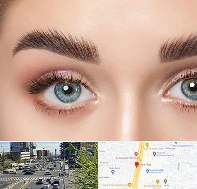 لیفت ابرو در ستاری