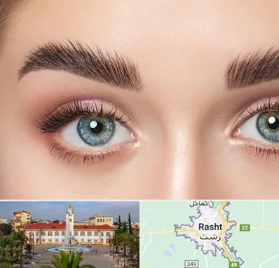 لیفت ابرو در رشت