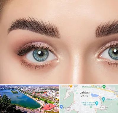 لیفت ابرو در لاهیجان