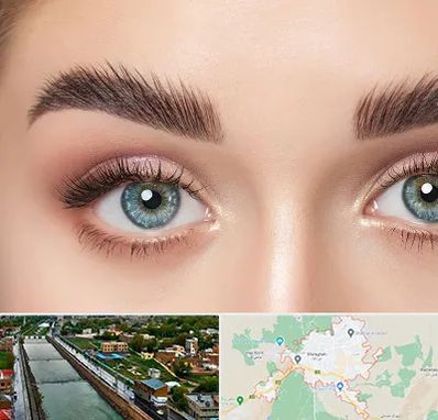 لیفت ابرو در مراغه