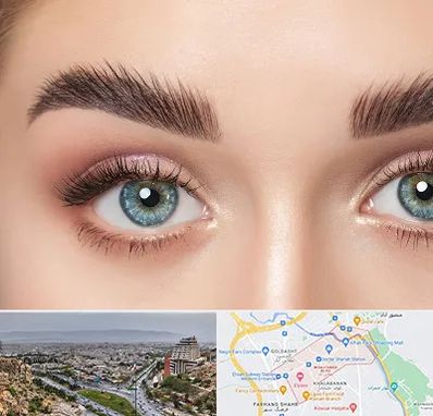 لیفت ابرو در معالی آباد شیراز