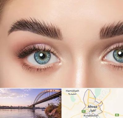 لیفت ابرو در اهواز