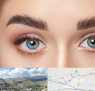 لیفت ابرو در رودهن