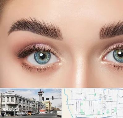 لیفت ابرو در 17شهریور