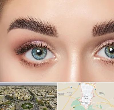 لیفت ابرو در قزوین