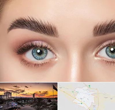 لیفت ابرو در قوچان