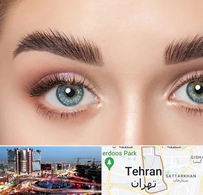 لیفت ابرو در صادقیه 