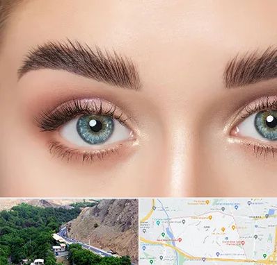 لیفت ابرو در کن