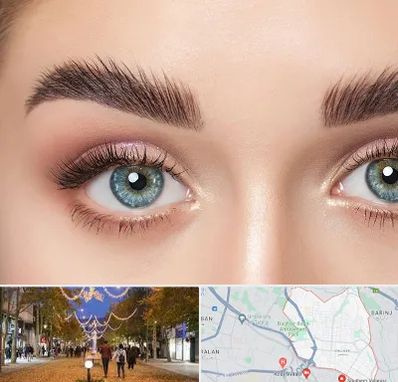 لیفت ابرو در ولیعصر ارومیه