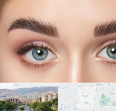 لیفت ابرو در خانی آباد