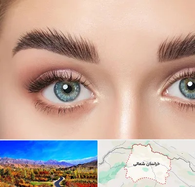 لیفت ابرو در خراسان شمالی